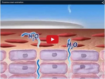 Eczema cream TVC - animated TV commercial