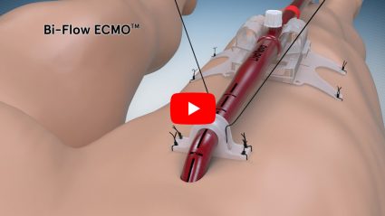 Animated medical video by Aarons CGI